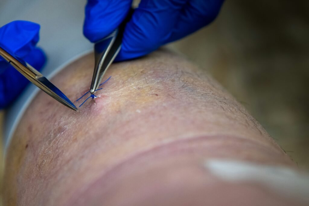 How Long Does It Take for a Cyst to Go Away? Complete Healing Timeline & Expert Guidance covering cyst recovery, symptoms, healing factors, self-care, and medical treatment.