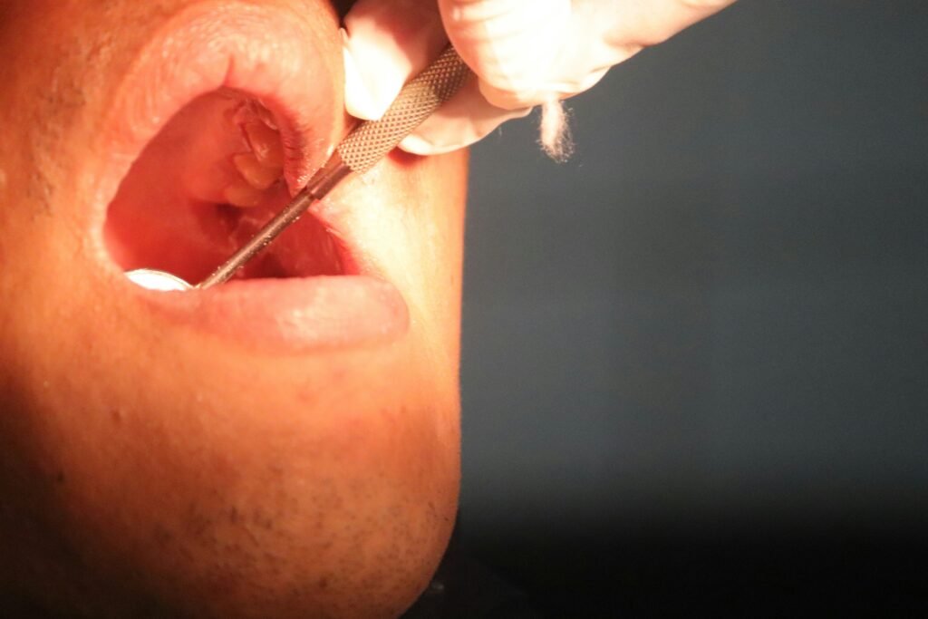 How to Squeeze Out Salivary Gland Stone Safe Removal Options guide featuring salivary stone symptoms, safe care, hydration, removal methods, and medical help.